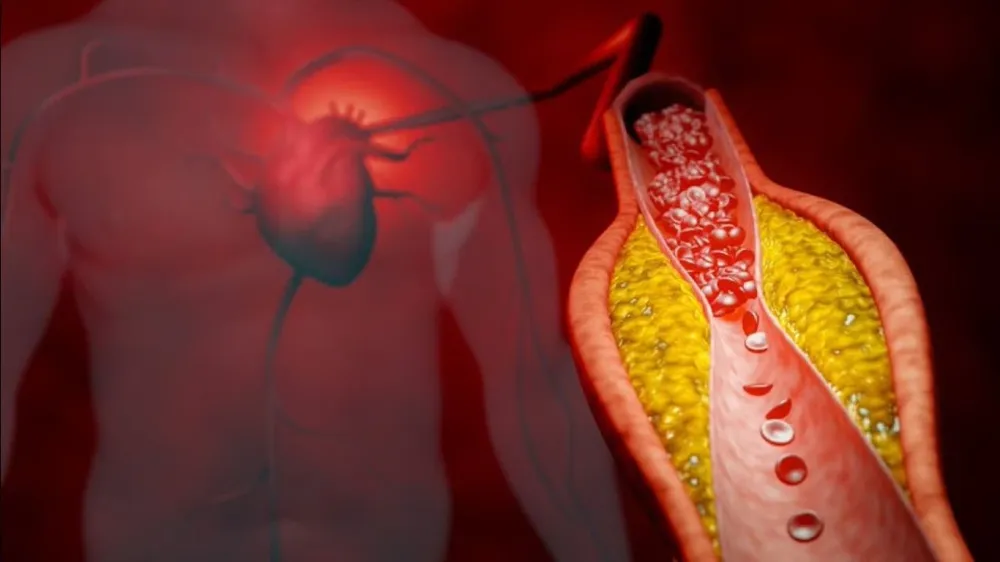 Başhekim Sarıkaya: Göbek ve insülin direnci, kardiyometabolik riskin sessiz ortakları