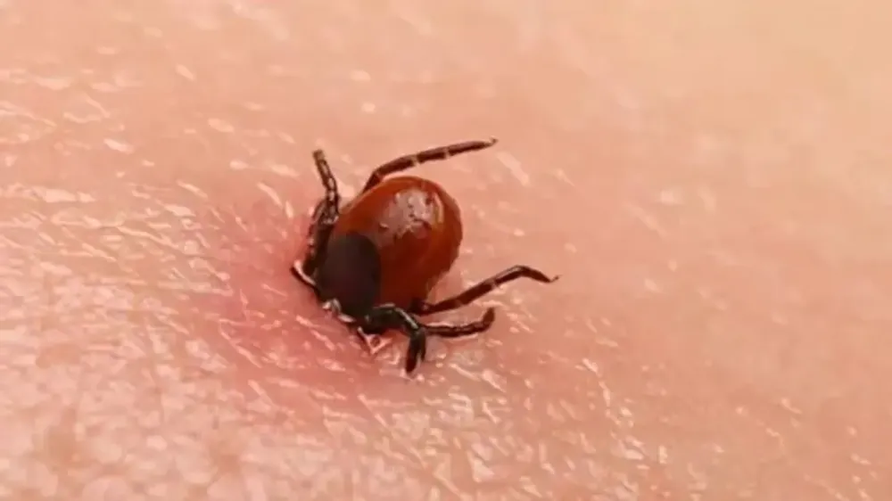Uzmanlardan Vanlılara kene uyarısı